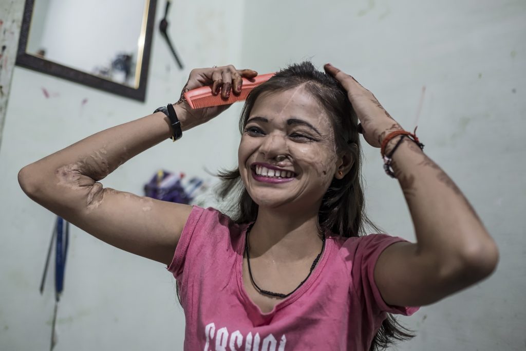 Khushboo: Young Dreams and Acid Attack | The Stories Of Change