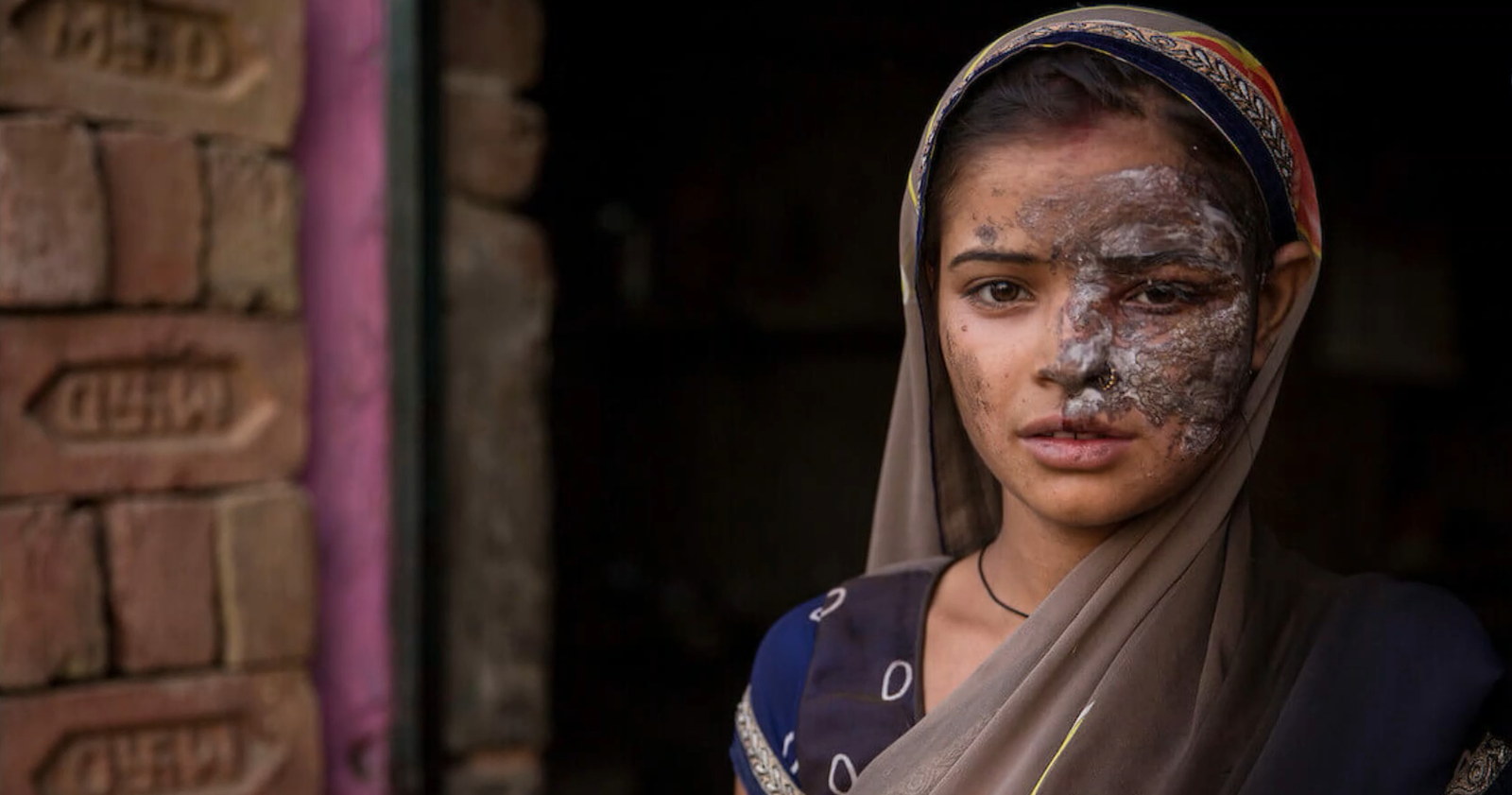 1676px x 881px - Khushboo: Young Dreams and Acid Attack | The Stories Of Change