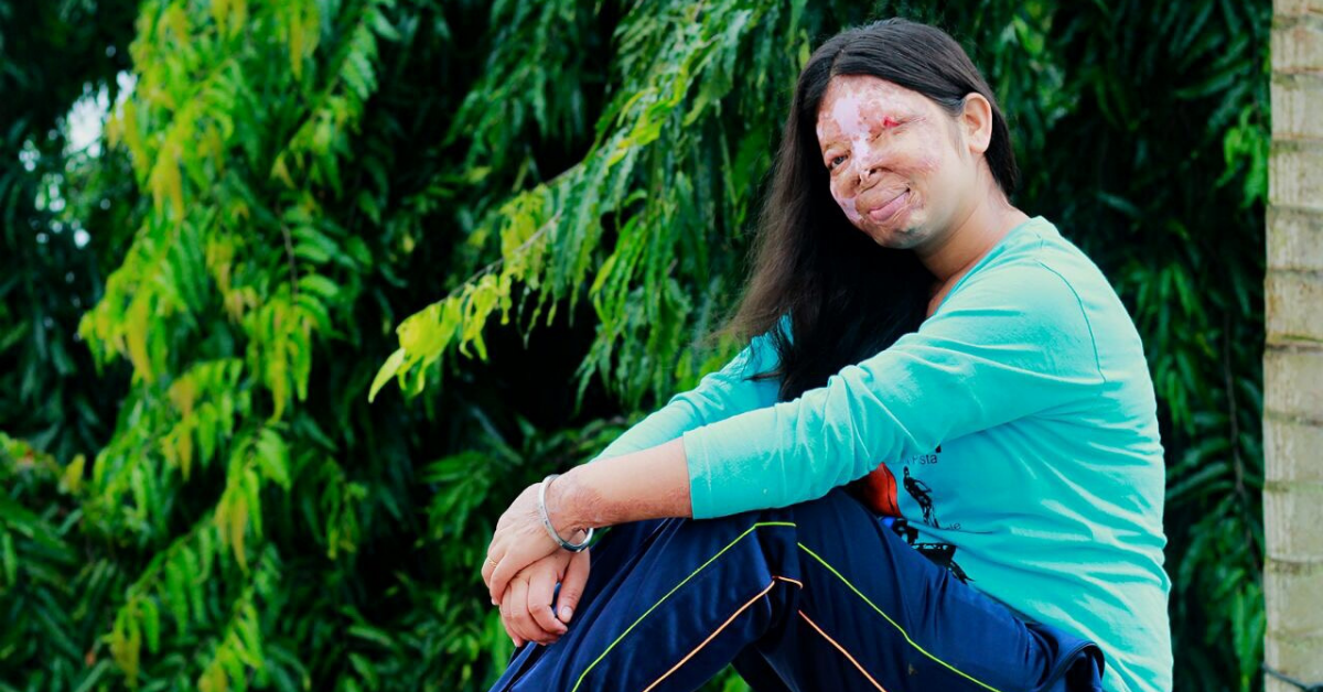 Anshu: Finding the lost identity after acid attack | The Stories Of Change