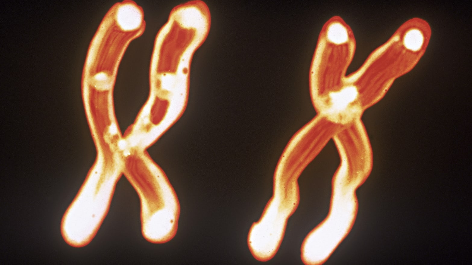 Scientific Breakthrough: Full sequence of human Y chromosome unveiled | The  Stories Of Change